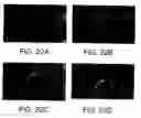 Fig. 28 - Wound Healing Compounds And Methods