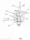 Fig. 02 - Bone anchored bone conductive hearing aid