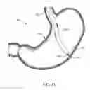 Fig. 06 - Systems, devices and methods for accessing a bodily opening