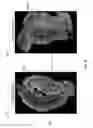 Fig. 09 - Diffusion tensor imaging-based alzheimer's diagnosis method