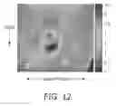 Fig. 09 - Method and system of strain gain compensation in elasticity imaging
