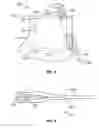 Fig. 04 - DEVICE AND METHOD FOR IDENTIFYING TAMPERING OF AN ULTRASOUND PROBE