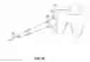 Fig. 16 - Implant inserter device