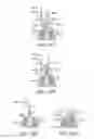 Fig. 45 - KNOTLESS SUTURE ANCHOR AND METHODS OF USE