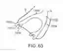 Fig. 49 - KNOTLESS SUTURE ANCHOR AND METHODS OF USE