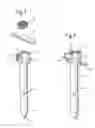 Fig. 02 - Bone anchoring nail