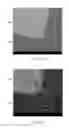 Fig. 09 - A METHOD OF PRODUCING A RING ELECTRODE OF AN IMPLANTABLE LEAD