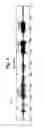 Fig. 04 - Method and Apparatus for Detection of Nervous System Disorders