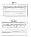 Fig. 22 - Method and Apparatus for Detection of Nervous System Disorders