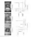 Fig. 02 - Methods of preventing ischemic injury using peripheral nociceptive stimulation