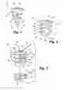 Fig. 02 - Bioelectric implant and method