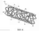 Fig. 07 - Bioerodible Endoprosthesis