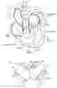 Fig. 02 - Actuating mechanism for pneumatically-driven artificial heart