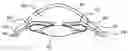 Fig. 01 - Refractive intraocular implant lens and method