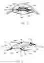 Fig. 03 - Refractive intraocular implant lens and method