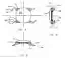 Fig. 04 - Refractive intraocular implant lens and method