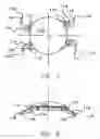 Fig. 05 - Refractive intraocular implant lens and method