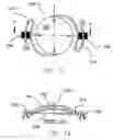 Fig. 09 - Refractive intraocular implant lens and method
