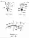Fig. 23 - Refractive intraocular implant lens and method