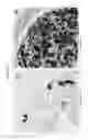 Fig. 37 - Fully synthetic implantable multi-phased scaffold
