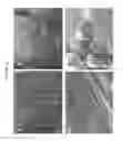 Fig. 53 - Fully synthetic implantable multi-phased scaffold