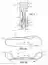 Fig. 02 - Prosthetic ligament system for knee joint