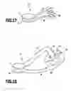 Fig. 09 - Facet joint implant