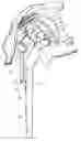 Fig. 01 - SHOULDER REPLACEMENT
