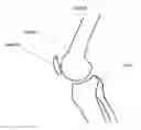 Fig. 02 - Method forming a one-piece articulating spacing device for a knee joint