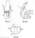 Fig. 03 - Systems and methods for providing deeper knee flexion capabilities for knee prosthesis patients