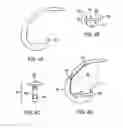 Fig. 05 - Systems and methods for providing deeper knee flexion capabilities for knee prosthesis patients