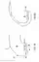 Fig. 06 - Systems and methods for providing deeper knee flexion capabilities for knee prosthesis patients