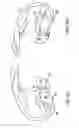 Fig. 07 - Systems and methods for providing deeper knee flexion capabilities for knee prosthesis patients