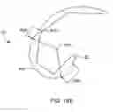Fig. 26 - Systems and methods for providing deeper knee flexion capabilities for knee prosthesis patients