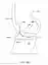 Fig. 29 - Systems and methods for providing deeper knee flexion capabilities for knee prosthesis patients