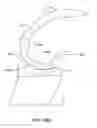 Fig. 35 - Systems and methods for providing deeper knee flexion capabilities for knee prosthesis patients