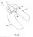 Fig. 55 - Systems and methods for providing deeper knee flexion capabilities for knee prosthesis patients