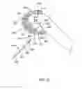 Fig. 56 - Systems and methods for providing deeper knee flexion capabilities for knee prosthesis patients