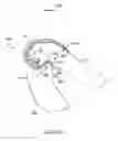 Fig. 59 - Systems and methods for providing deeper knee flexion capabilities for knee prosthesis patients