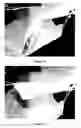 Fig. 11 - METHOD, SYSTEM AND APPARATUS FOR REAL-TIME CLASSIFICATION OF MUSCLE SIGNALS FROM SELF -SELECTED INTENTIONAL MOVEMENTS