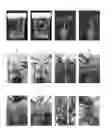 Fig. 01 - Composition and Method for Prolonging the Shelf Life of Banana by Using Interfering RNA