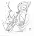 Fig. 09 - Apparatus for cotton ginning, processes and methods associated therewith