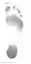 Fig. 02 - Foot type and plantar pressure measuring device