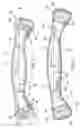 Fig. 02 - Saddle girth