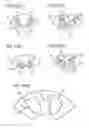 Fig. 13 - Combustor for a gas-turbine engine with angled pilot fuel nozzle