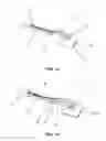 Fig. 02 - Dent removal tool