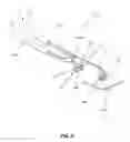 Fig. 09 - Dent removal tool
