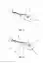 Fig. 02 - Dent removal tool