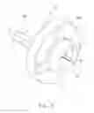 Fig. 08 - Method for making mold core
