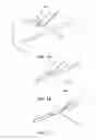 Fig. 02 - System for variable-angle cutting of a suture to create tissue retainers of a desired shape and size